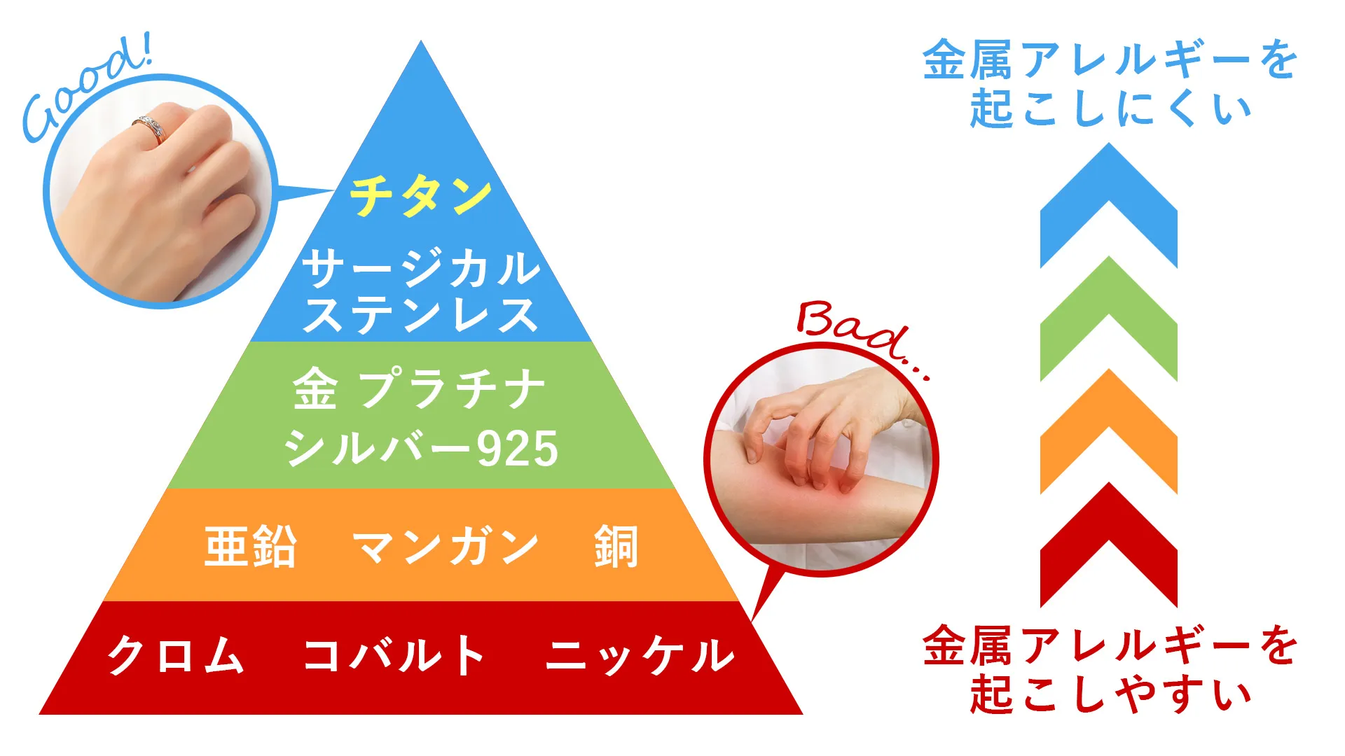 金属アレルギーになりやすい金属となりにくい金属の分布画像